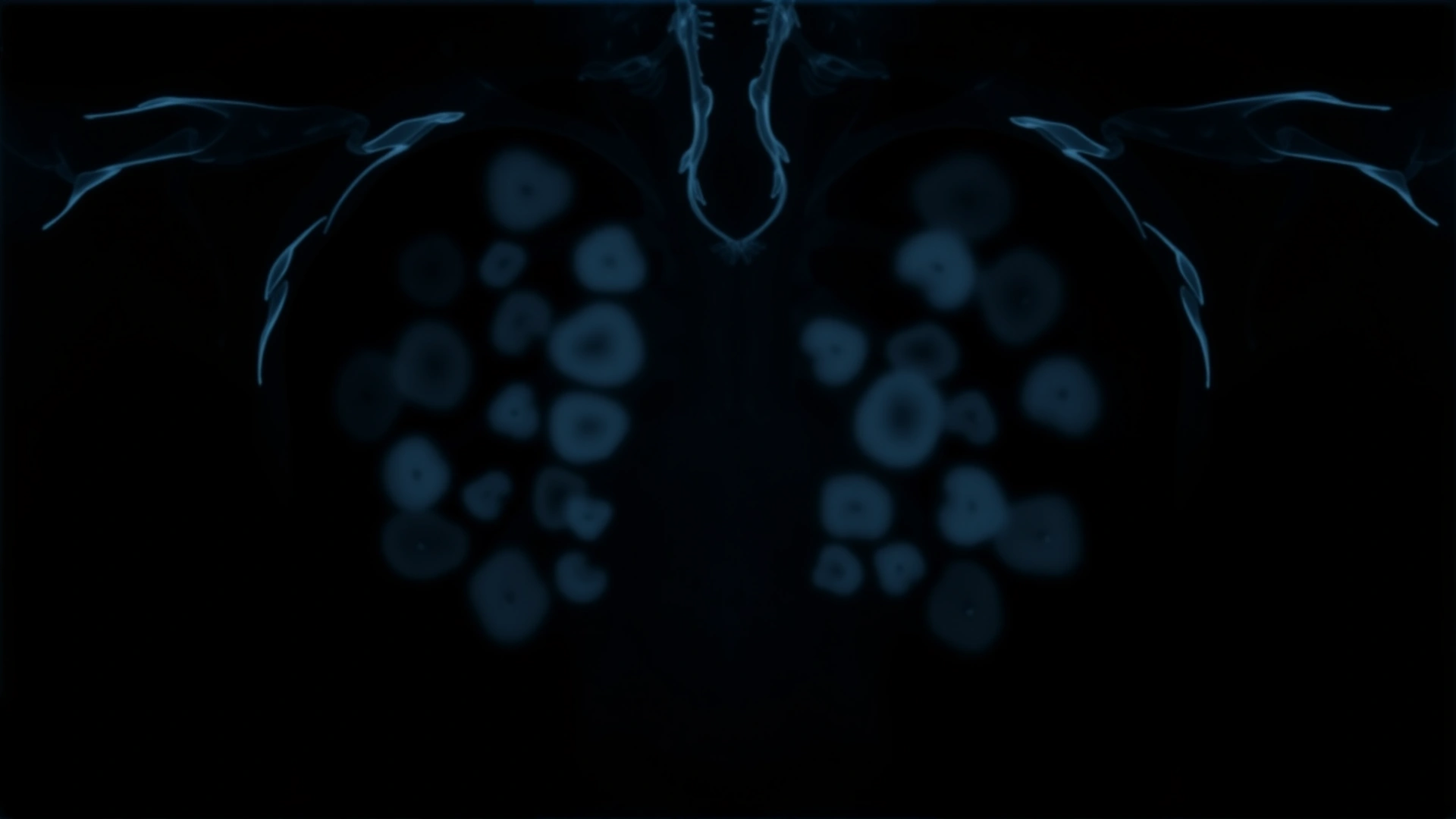 High-contrast veterinary radiograph displaying a feline thoracic cavity with multiple nodular opacities, illustrating pulmonary nocardiosis. No text or annotations.
