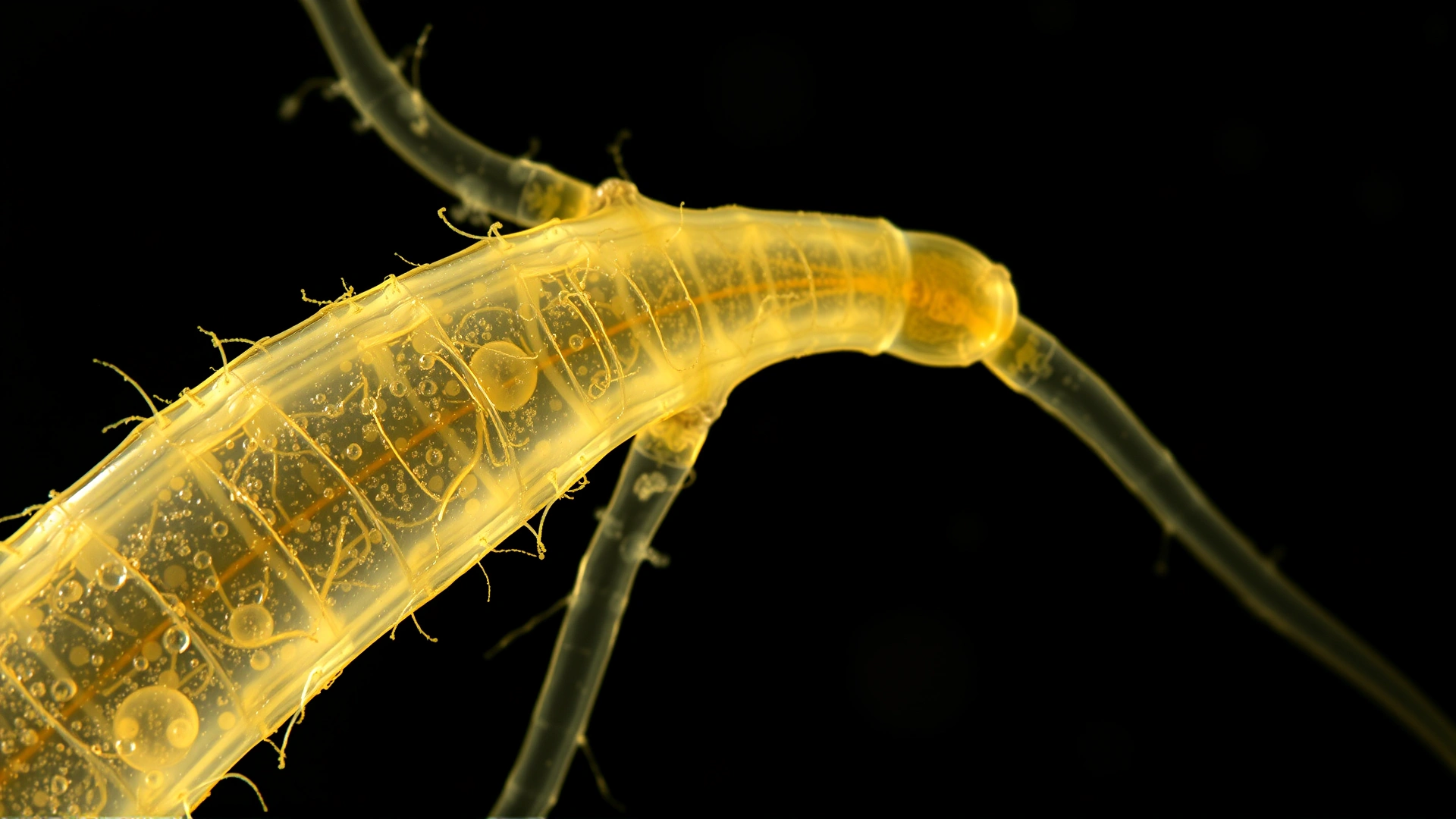 High-detail microscopic view of a translucent roundworm (Capillaria) under brightfield illumination, no labels or text