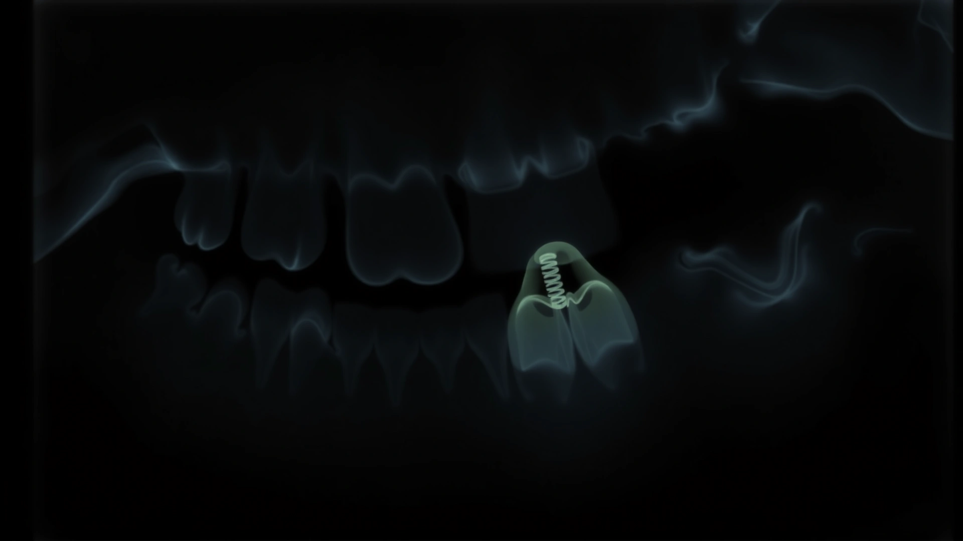 Digital dental X-ray image showing a feline tooth root abscess highlighted, monochrome, clinical style
